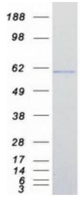 Coomassie blue staining of purified IRF7 protein.